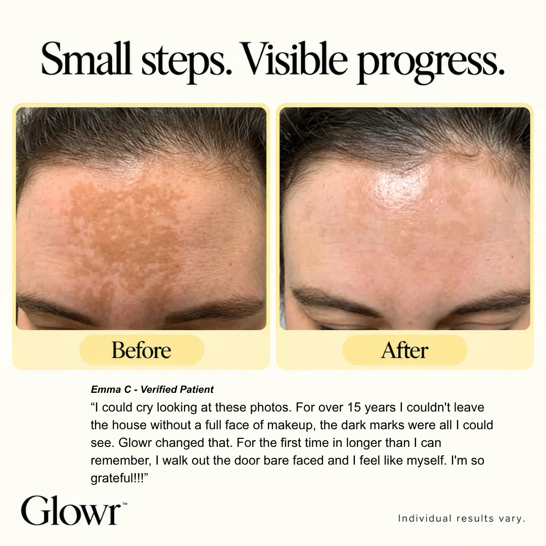 Glowr Glutathione Dark Spot Serum Patch 7